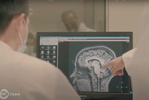 detecci&oacute;n del alzh&eacute;imer