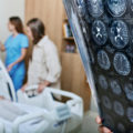 Un proyecto europeo mejorará el diagnóstico y tratamiento de las enfermedades neurodegenerativas