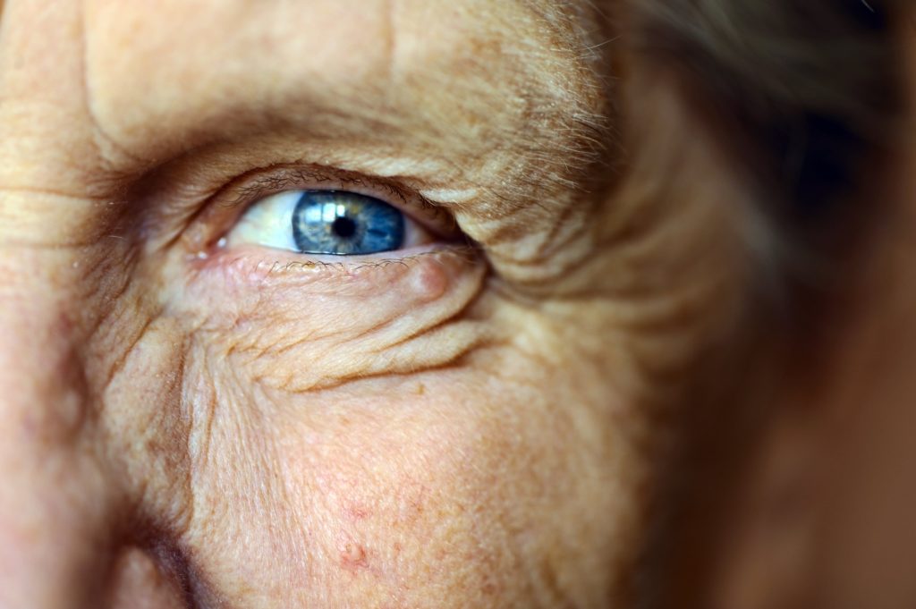 Problemas de visión y cirugía de cataratas en personas mayores.