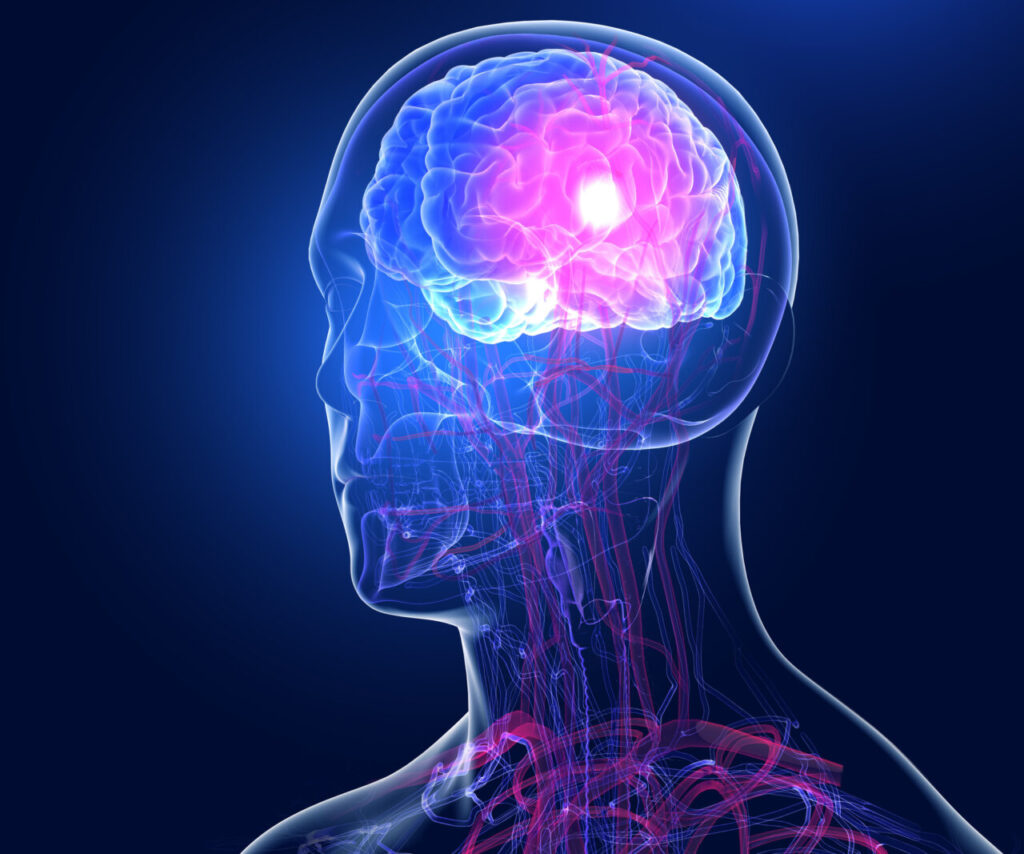 Matia Instituto y ATECE Gipuzkoa impulsan un innovador proyecto para mejorar la vida de las personas tras un ictus.