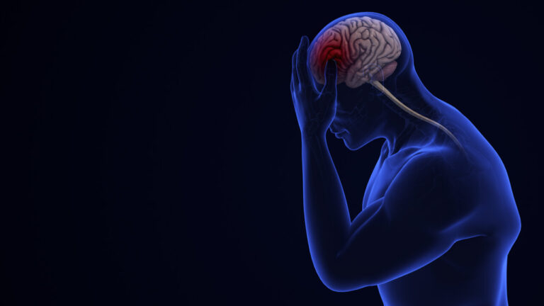 La SEN alerta de que más de 1,5 millones de europeos sufrirán un ictus este año.